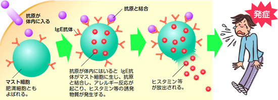 アレルギー発症のしくみ(㈵型)