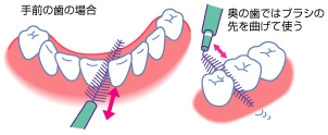 歯間ブラシの図