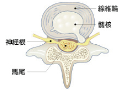 椎間板を上から見た図